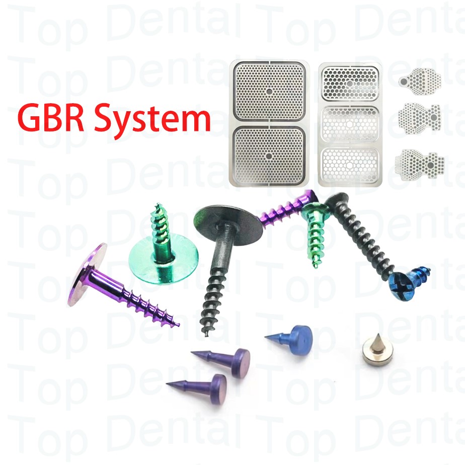 Stabilizer Screw In - 10 stücke Dental GBR System Knochen