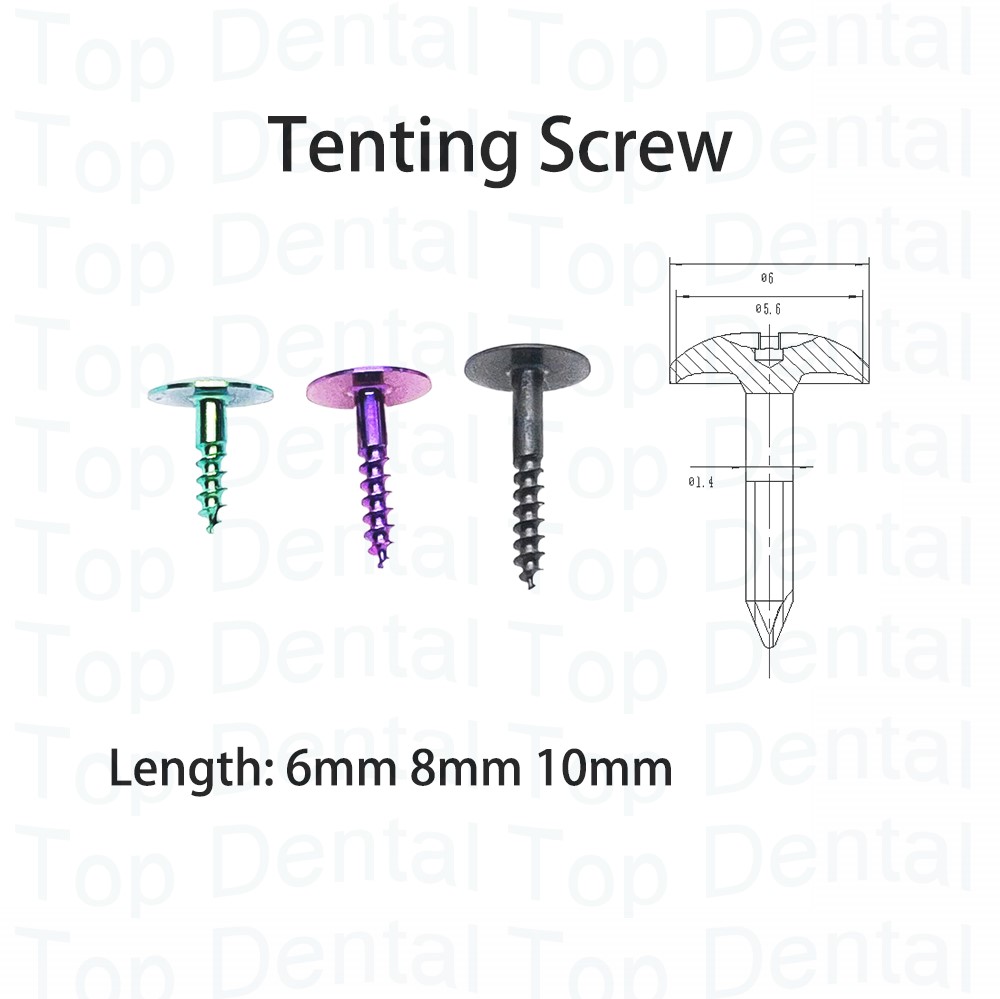 10 stücke Dental GBR System Kn – Stabilizer Screw In Bewertung und Preis