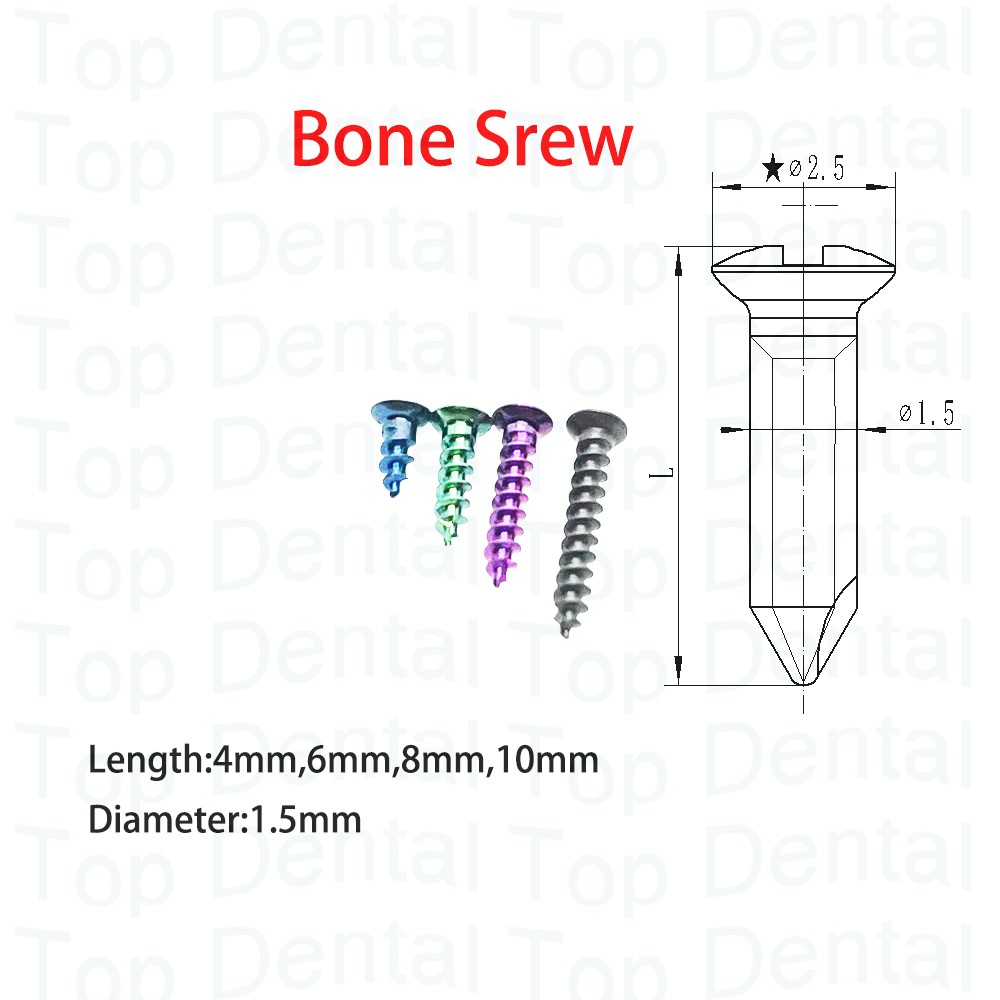 10 stücke Dental GBR System Kn – Stabilizer Screw In Bewertung und Preis